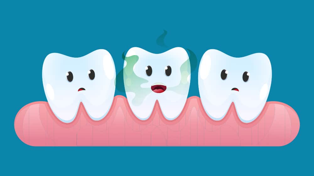 Cartoon drawing of a mouth indicating bad breath